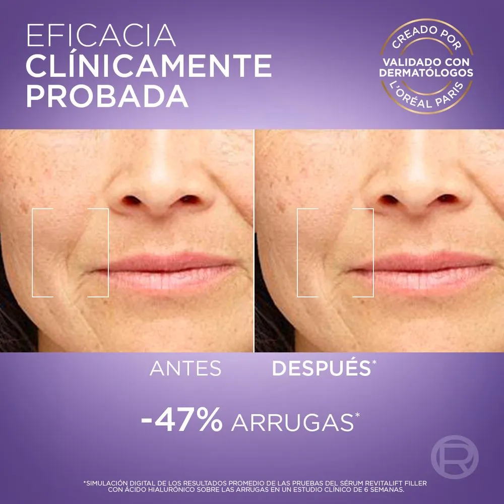 L'Oréal París Serum ácido hialurónico revitalift 30 ml
