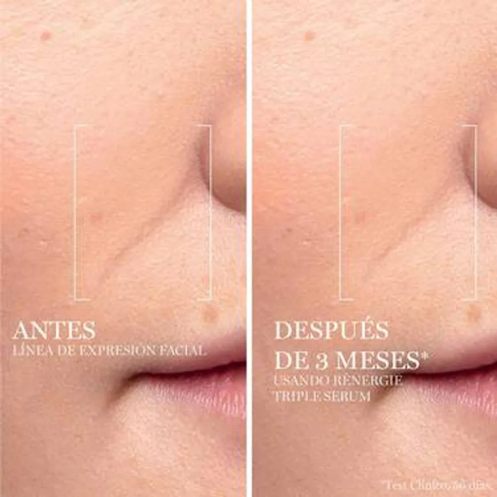 Lancôme Triple Sérum Rénergie Con Ácido Hialurónico + Vitamina C + Niacinamida